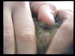Explicación peludo