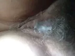 Coño descuidado